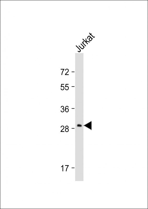 AQP5