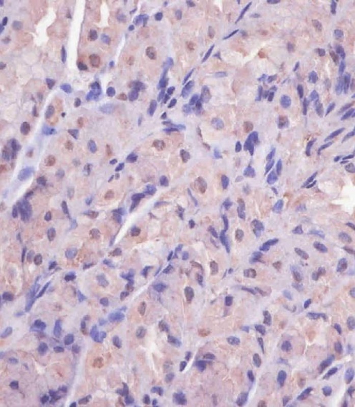 Rabbit Polyclonal Antibody to EIF4E2