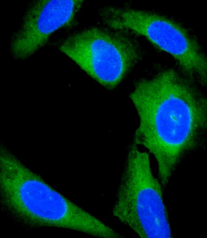 Rabbit Polyclonal Antibody to GCA (N-Term)