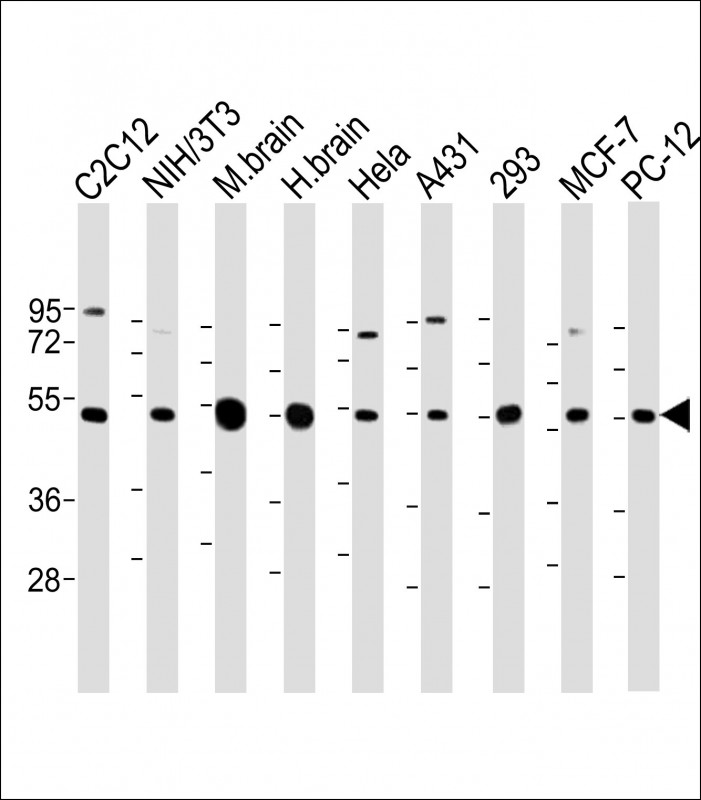 beta II Tubulin