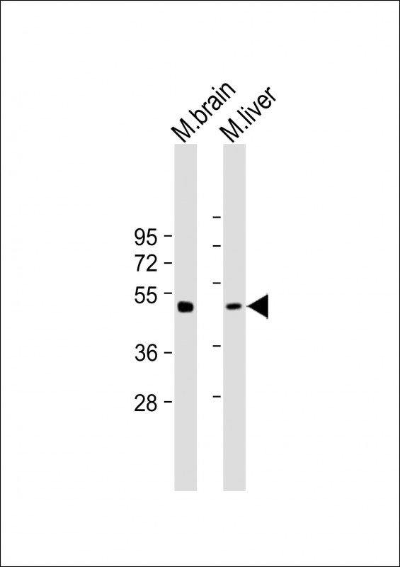 gamma Tubulin