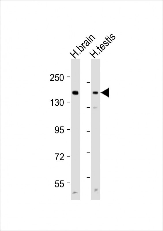 ABCC3