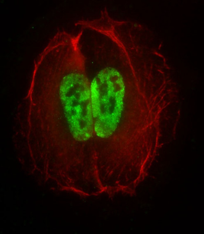 Rabbit Polyclonal Antibody to CRTR1 (N-term)