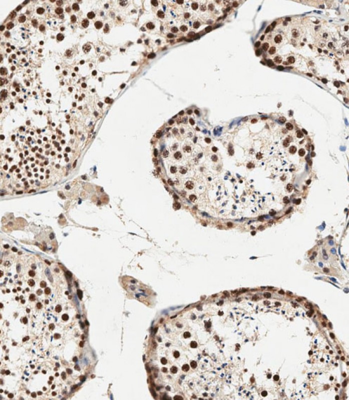 Rabbit Polyclonal Antibody to CRTR1 (N-term)