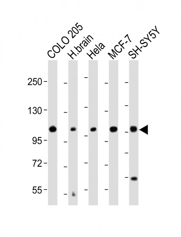 KCNH1