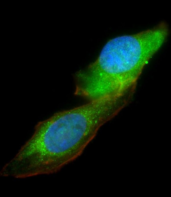 Rabbit Polyclonal Antibody to KCNH1