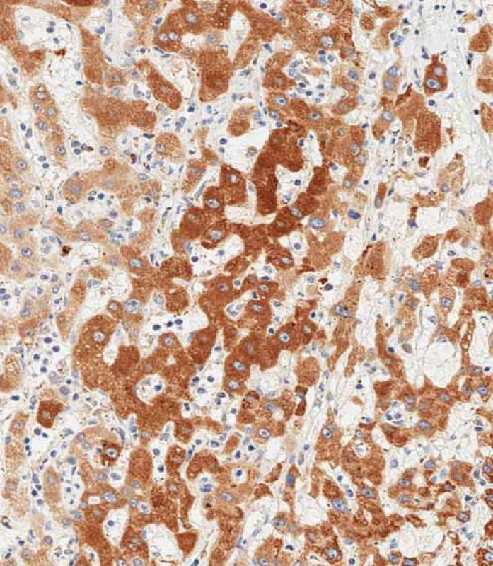 Rabbit Polyclonal Antibody to GPX7