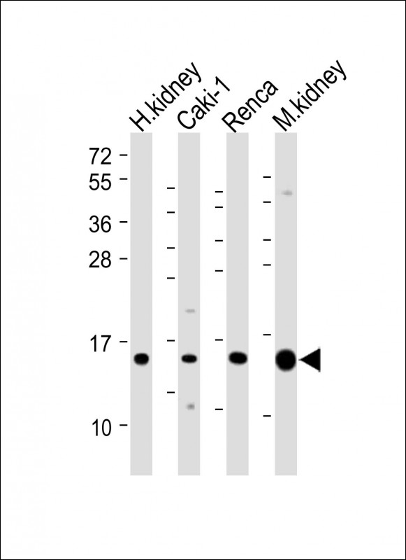 ATP6V1G3 (N-Term)