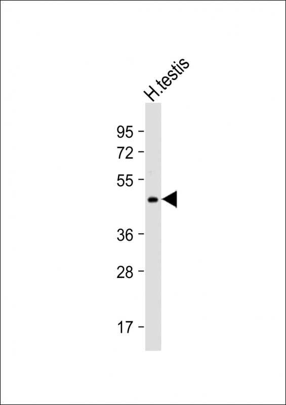 UBXN6  (C-term)