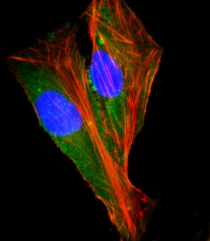 Rabbit Polyclonal Antibody to SHC2 (N-Term)