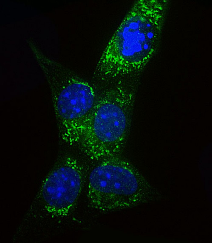 Rabbit Polyclonal Antibody to COXIV