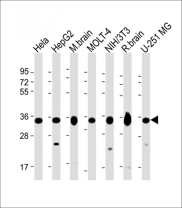 Rabbit Polyclonal Antibody to PITPNA