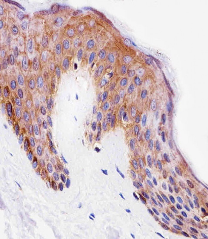 Rabbit Polyclonal Antibody to PITPNA