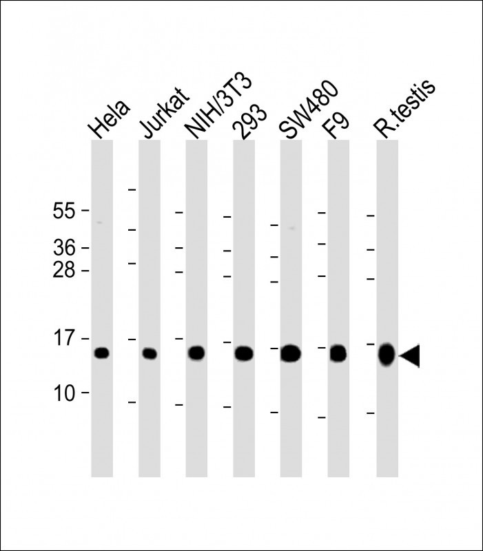 Rabbit Polyclonal Antibody to UBE2D2 (N-term)