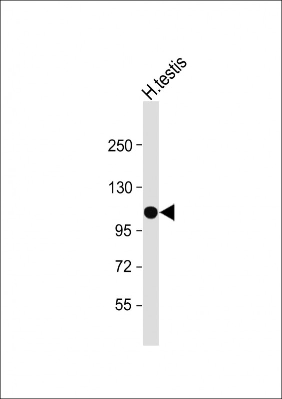 SLC14A2 (N-Term)