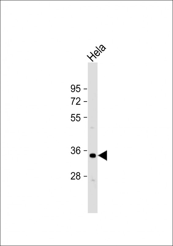 OR1B1