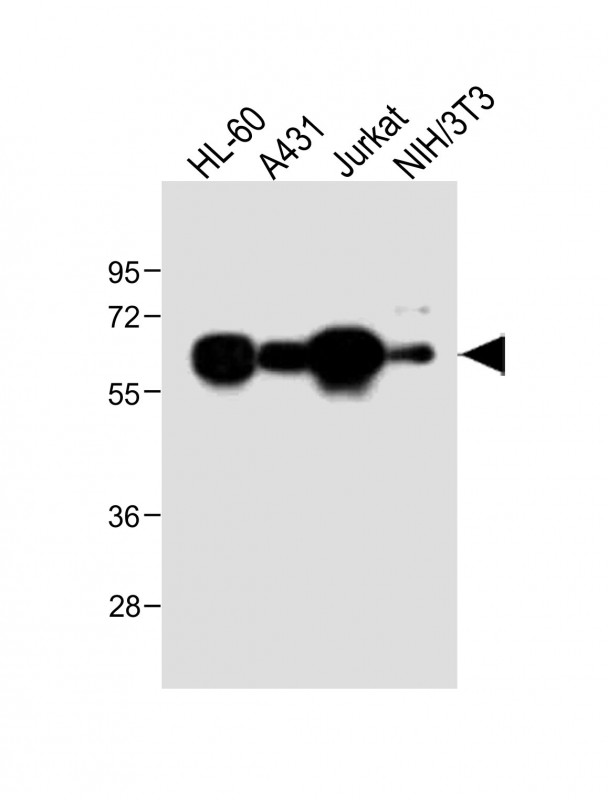METTL14 (N-Term)
