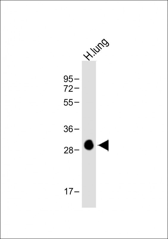 HLA-DPB1