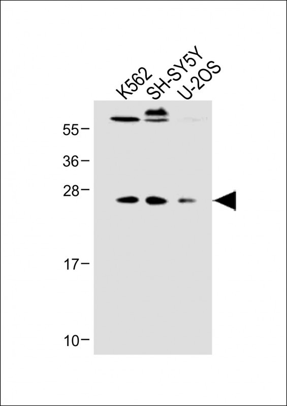N6AMT1 (N-term)