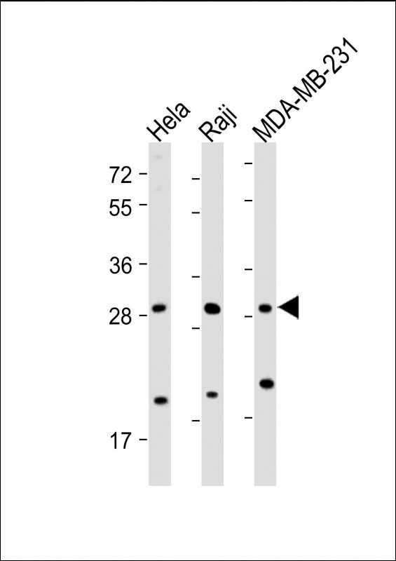RAB12 (N-term)