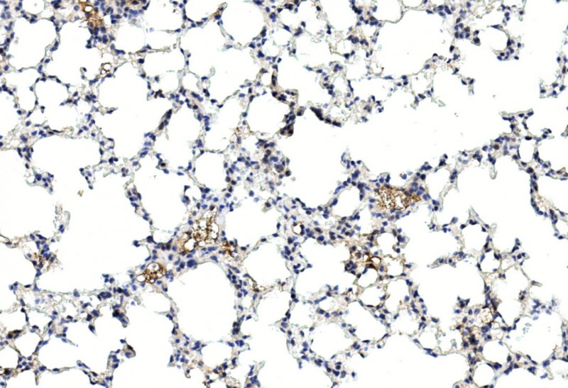 Rabbit Polyclonal Antibody to GREMLIN