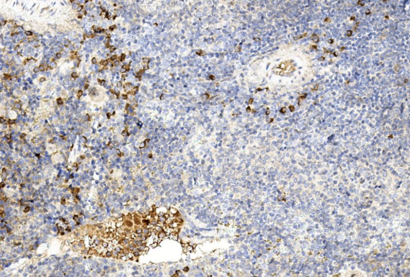 Rabbit Polyclonal Antibody to GREMLIN