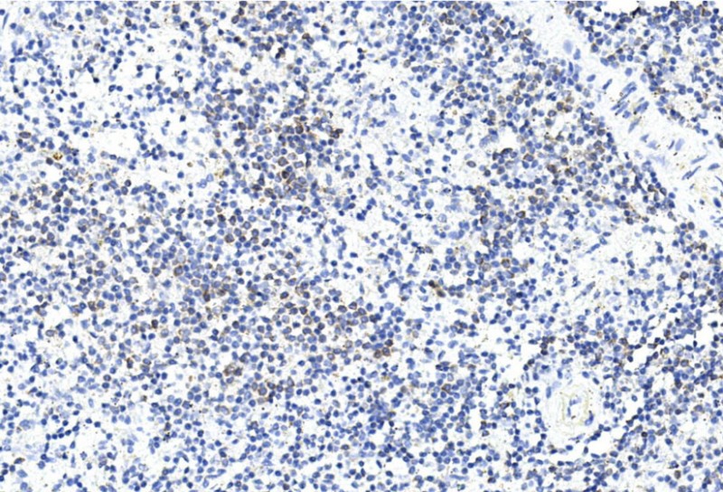 Rabbit Polyclonal Antibody to GREMLIN