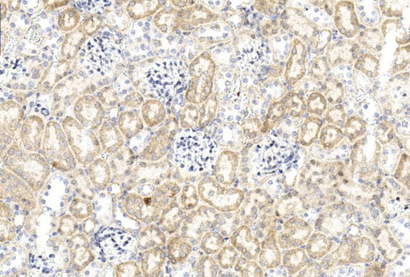 Rabbit Polyclonal Antibody to GREMLIN