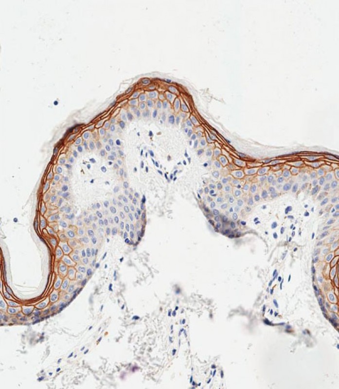 Rabbit Polyclonal Antibody to SCEL