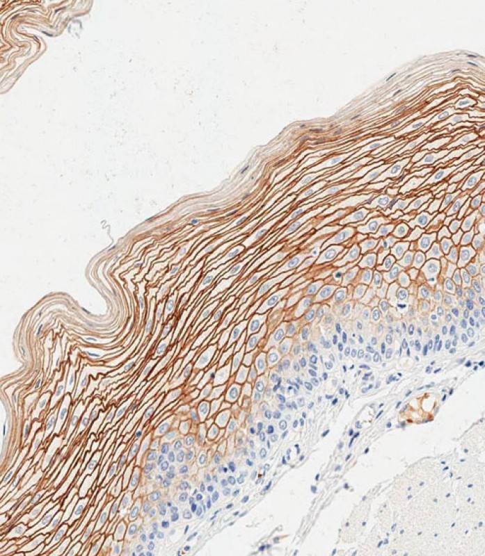 Rabbit Polyclonal Antibody to SCEL