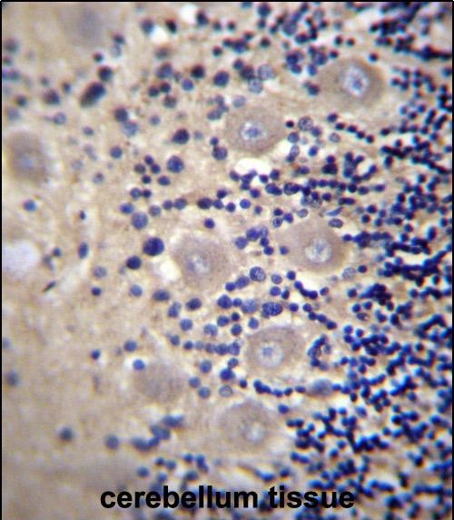 Rabbit Polyclonal Antibody to DRG1