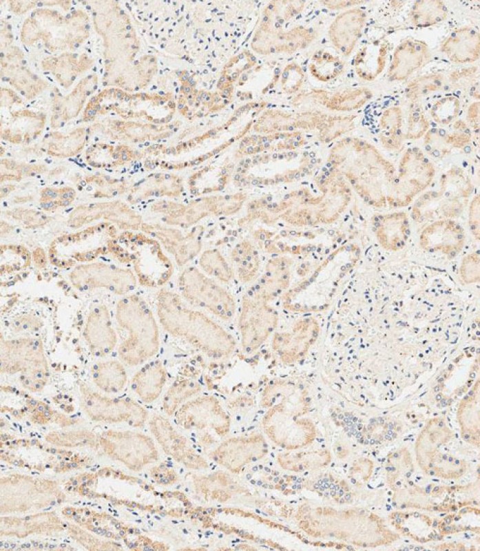 Rabbit Polyclonal Antibody to RAB28