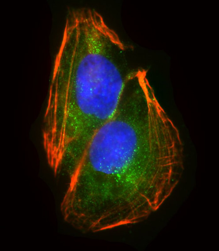 Rabbit Polyclonal Antibody to RS18