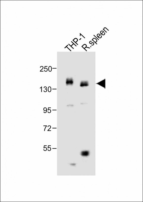 MCSF Receptor (CSF1R)