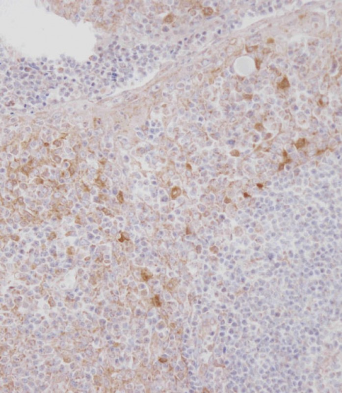 Rabbit Polyclonal Antibody to MCSF Receptor (CSF1R)