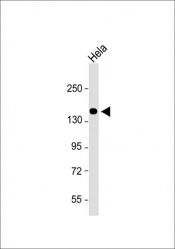 Rabbit Polyclonal Antibody to COL5A1 (N-term)