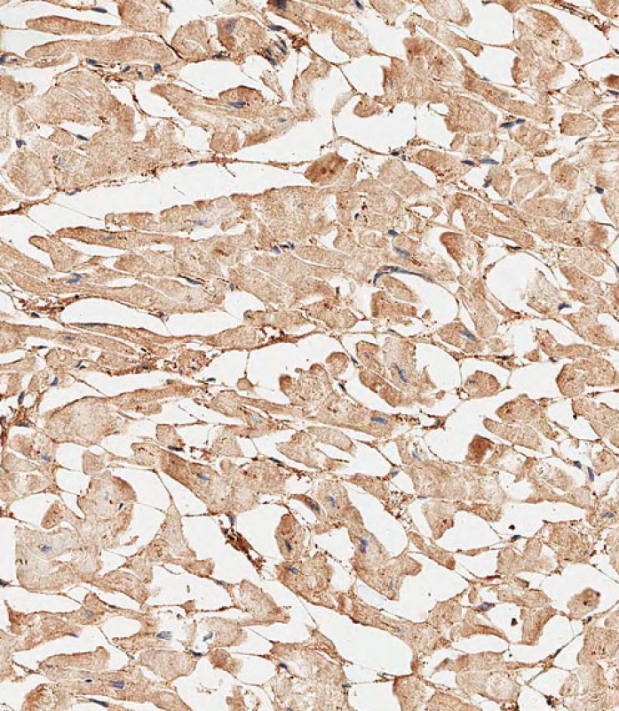 Rabbit Polyclonal Antibody to COL5A1 (N-term)