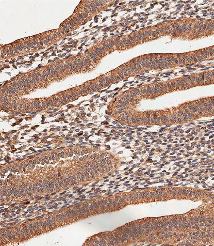 Rabbit Polyclonal Antibody to COL5A1 (N-term)
