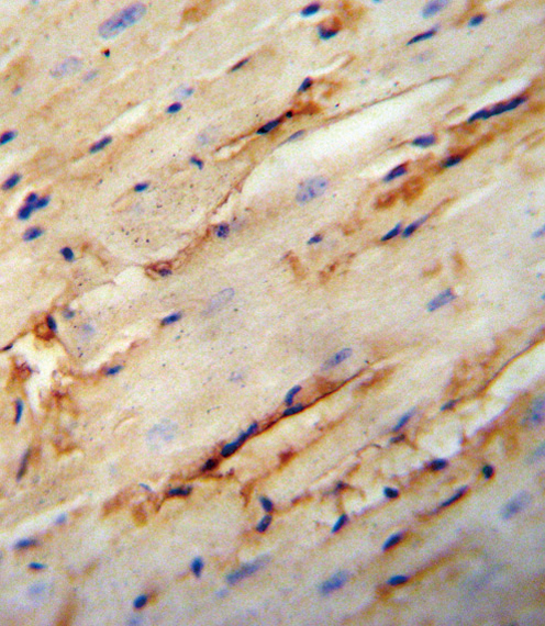 Rabbit Polyclonal Antibody to COL5A1 (N-term)