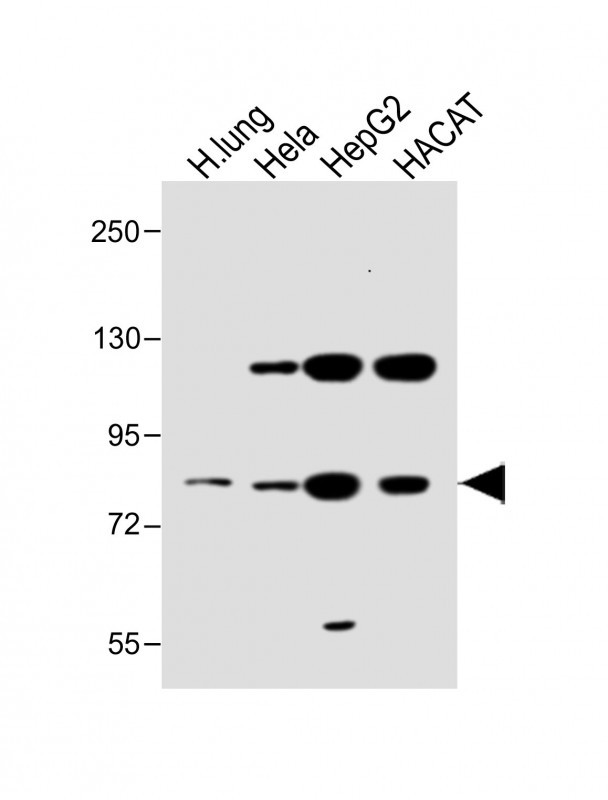 SLC6A14