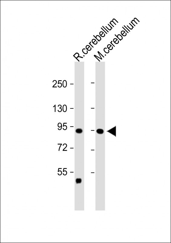 TRPV1 (N-term)