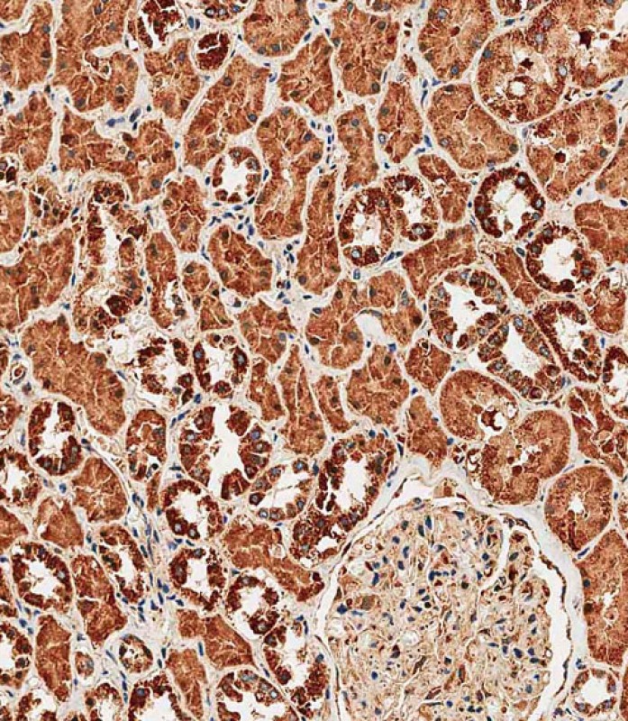 Rabbit Polyclonal Antibody to TRPV1 (N-term)