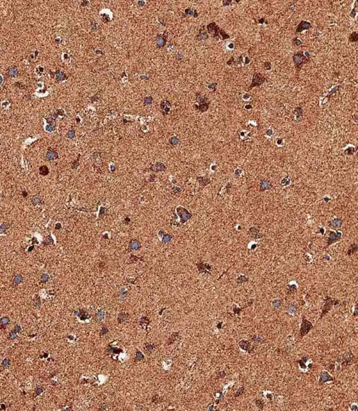 Rabbit Polyclonal Antibody to TRPV1 (N-term)