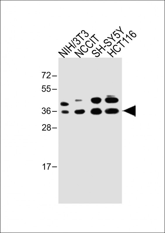 WDR82 (N-term)