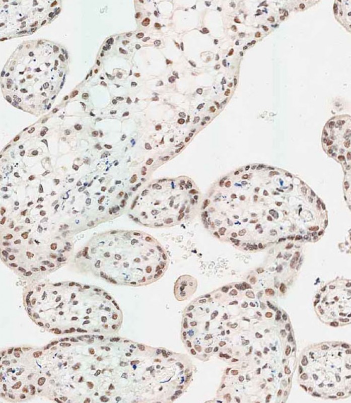 Rabbit Polyclonal Antibody to WDR82 (N-term)