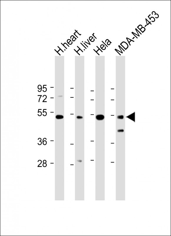 FBXL2