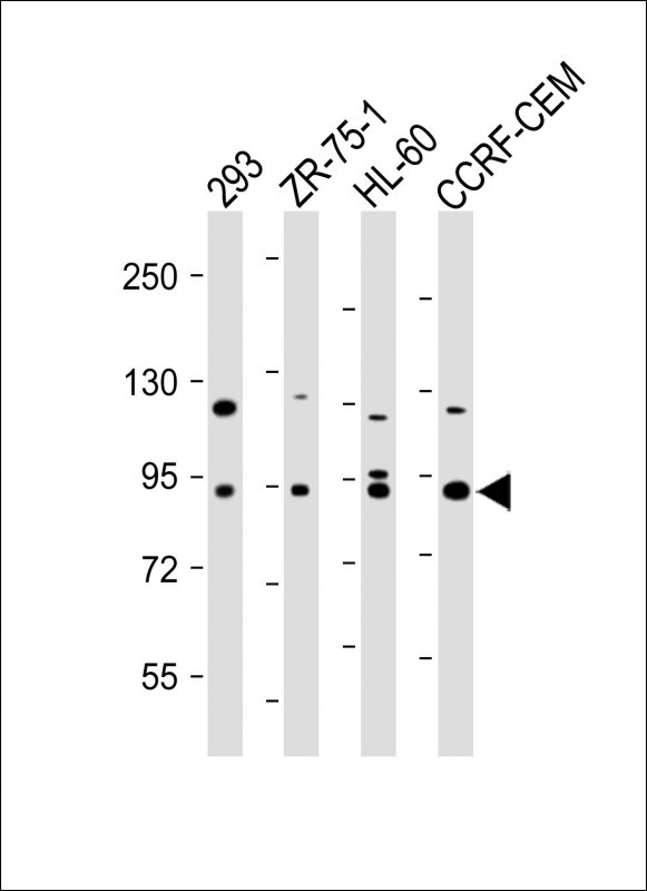 MMP9