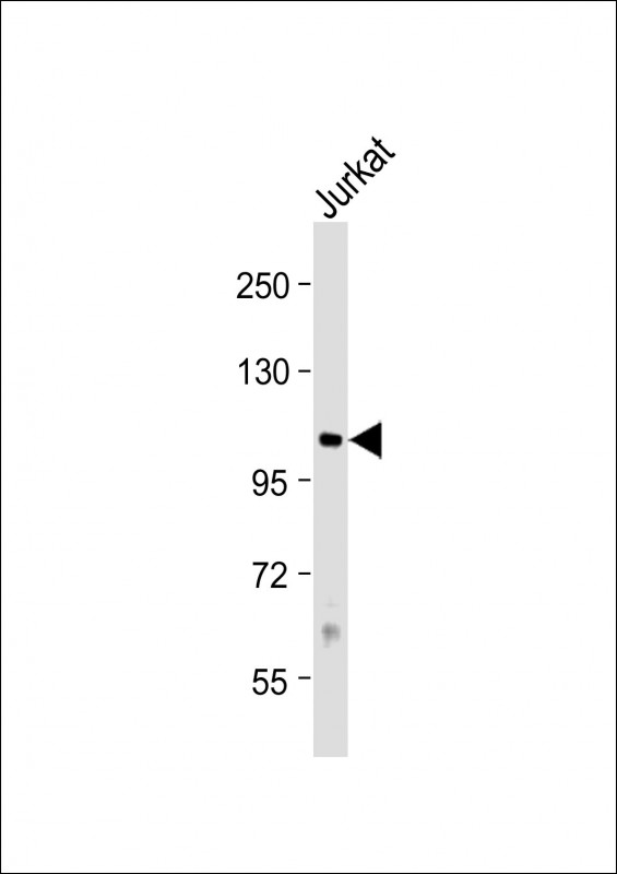 PRMT10 (N-term)