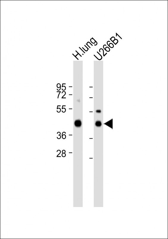 HLA-F