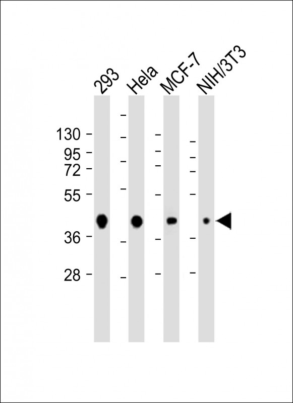 AKT1S1